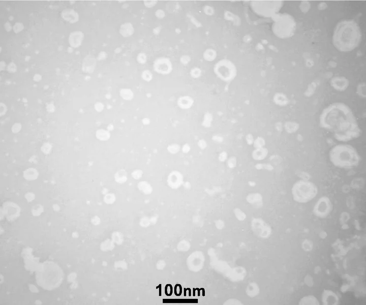 Electron micrograph of many small, ring-shaped vesicles scattered across the field, with a scale bar.