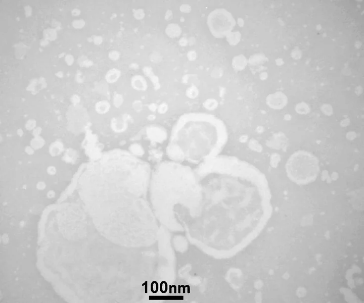 Electron micrograph of large rimmed vesicles, some nested, among smaller vesicles, with a scale bar.