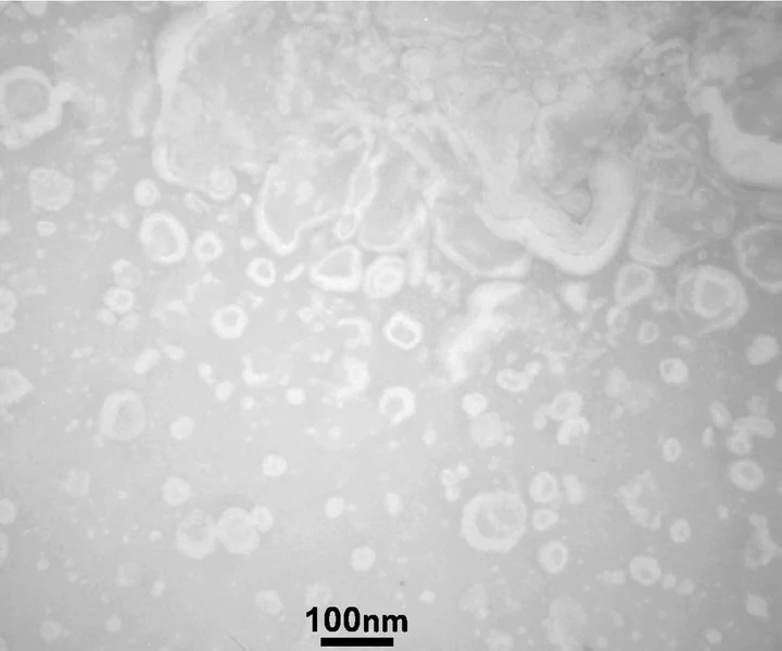 Electron micrograph of layered, sheet-like structures with ring-shaped vesicles at their margins, with a scale bar.